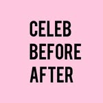 celebbeforeafter profile picture