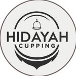 hidayah.cupping profile picture