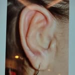 microtia.atresia.dubai profile picture