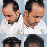 mukeshhairvlogs profile picture